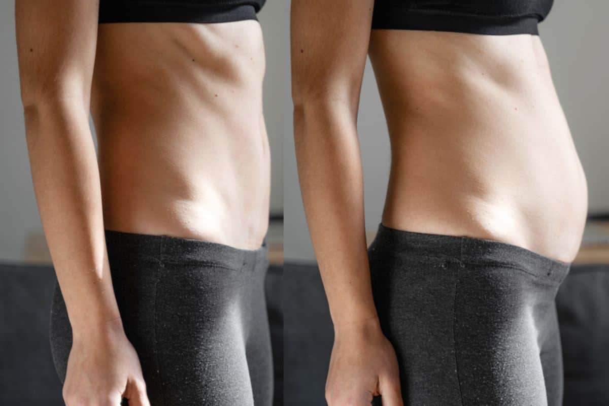 How long does diastasis recti take to improve Little Bognor?