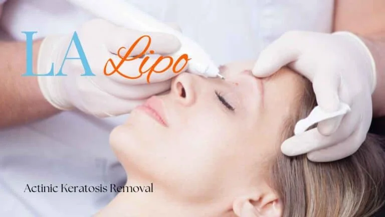 Woman receiving Actinic Keratosis Removal Treatment Little Bognor