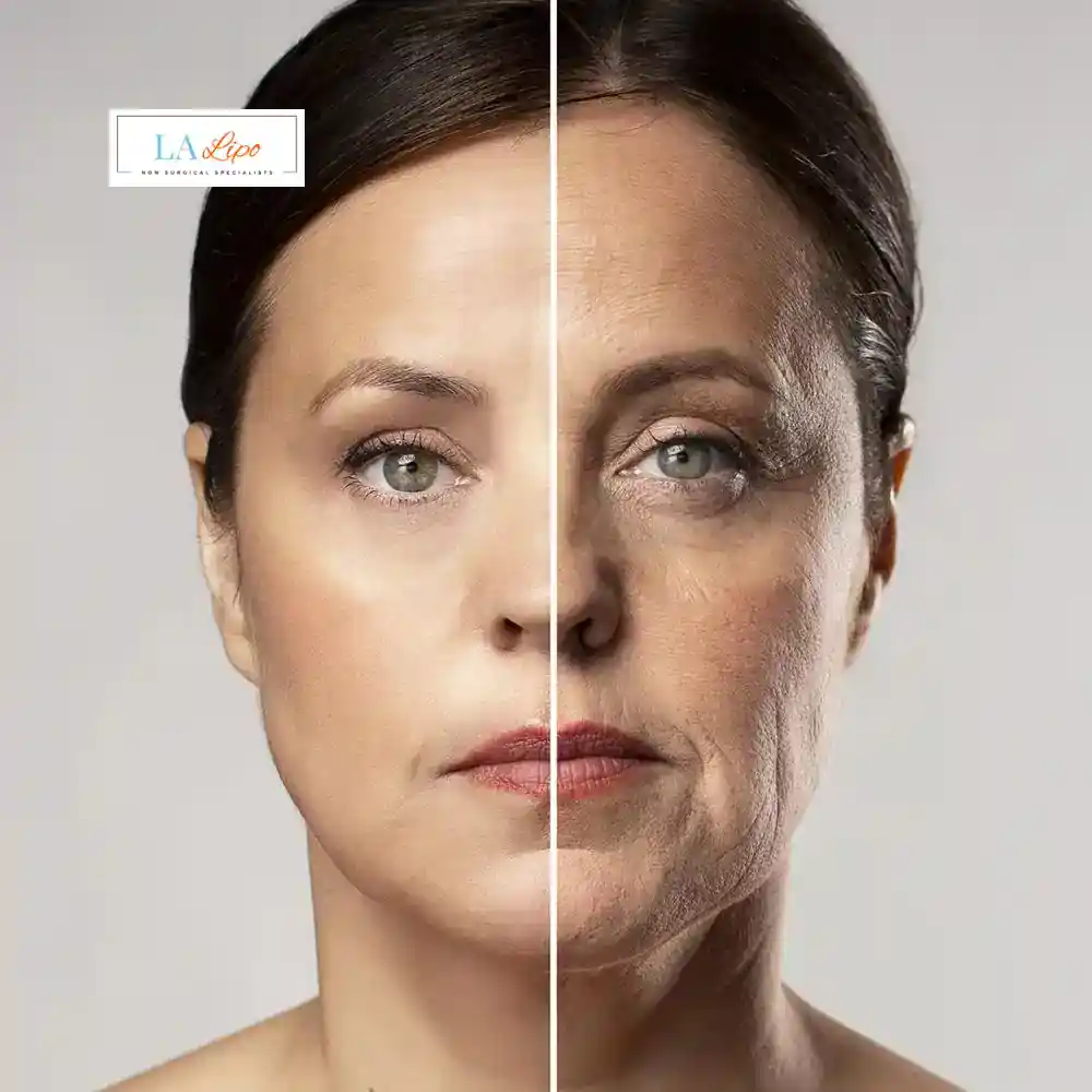How Can You Tell If Non-Surgical Skin Tightening Is Right for You Little Bognor?