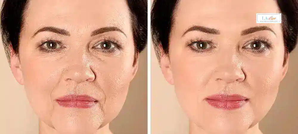 Why Aren’t My Skincare Products Making My Sagging Skin Look Firmer Little Bognor?