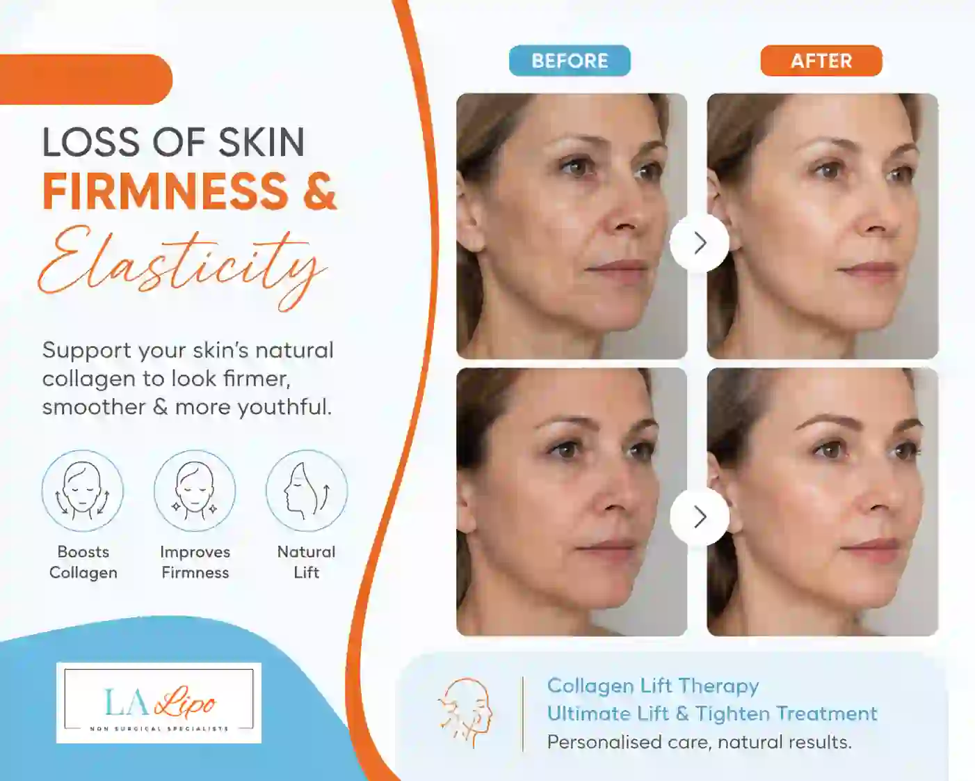 Sign #7: Loss of Skin Firmness and Elasticity Little Bognor