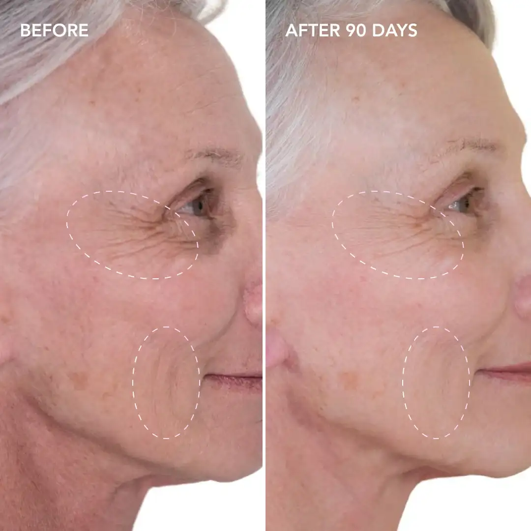 When will you see results Little Bognor